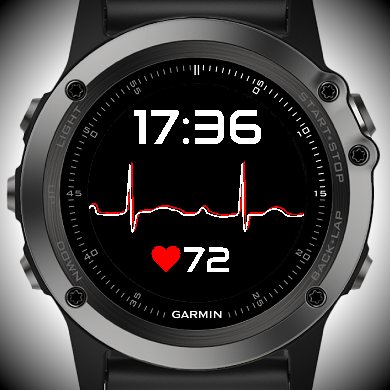 smartwatch ecg garmin